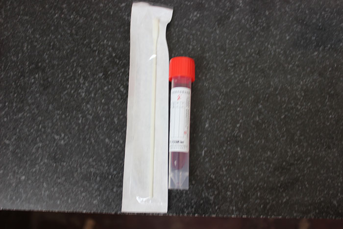 一次性使用病毒管具體采樣方法 一次性使用病毒管具體采樣方法